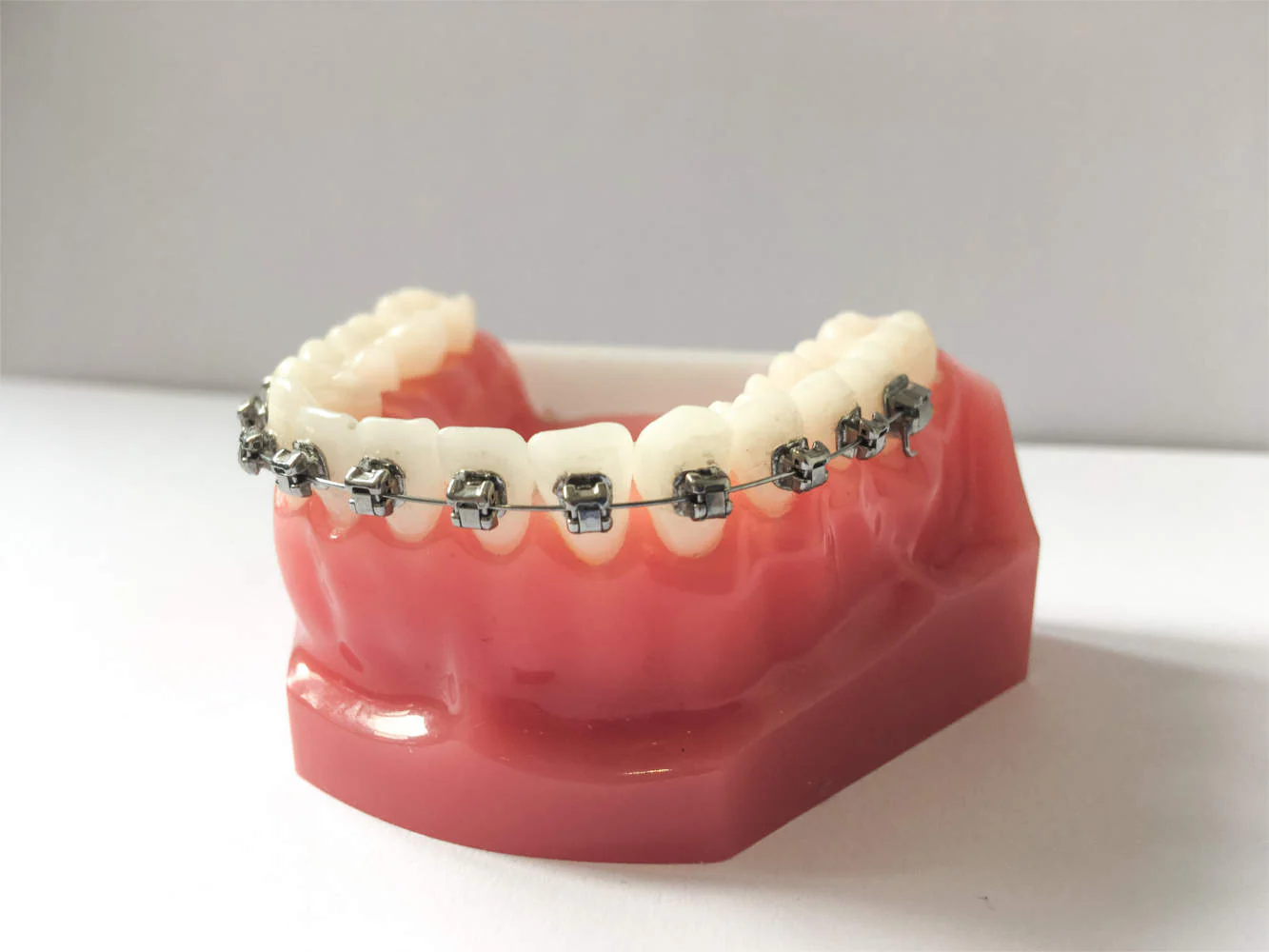 Our Orthodontic Treatments